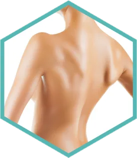 Hexagon crop of the back treatment area for Morpheus8 skin remodelling in London